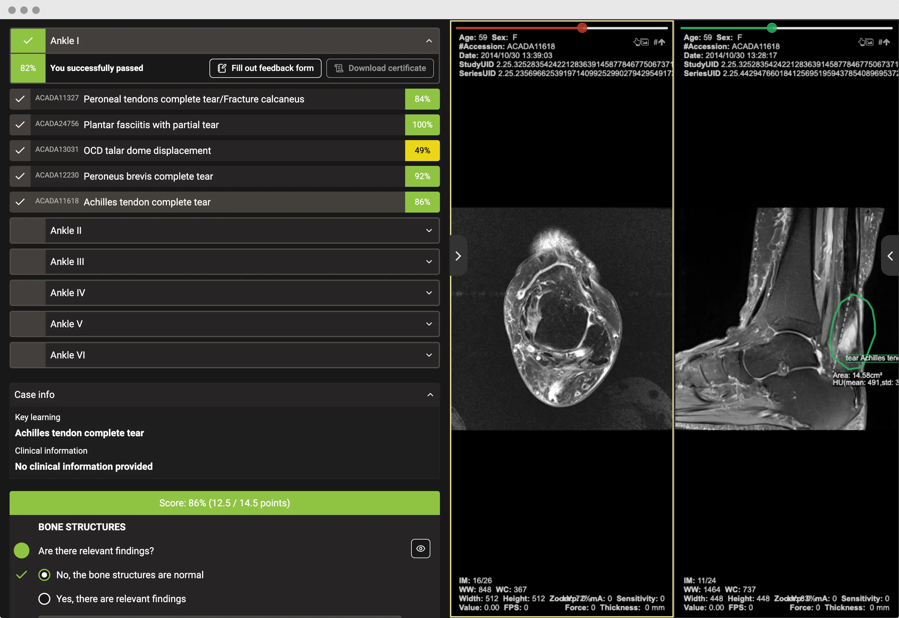 /images/product/simulator_main.png Radiology Reporting Simulator expert feedback interface